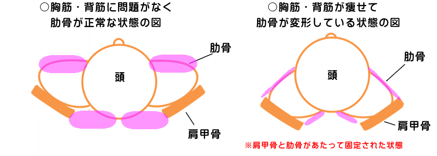 筋力低下が進む事で胸筋背筋が痩せ、肋骨がつくる呼吸器官や消化器官のスペースが狭くなる